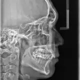 Vi from patreon